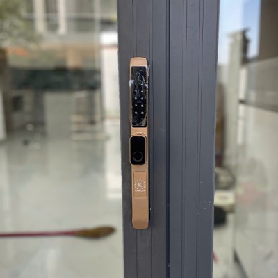 hình thực tế Kassler KL-599TN Champage Gold